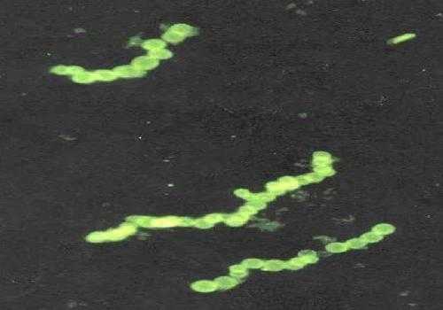 Фото: Thiomargarita namibiensis