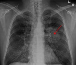 Виды, источники и причины загрязнения окружающей природной среды