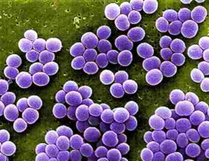 Страшные и опасные болезни человека вызываемые бактериями