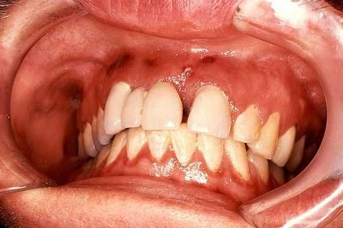 Самые интересные и увлекательные факты про бактерий