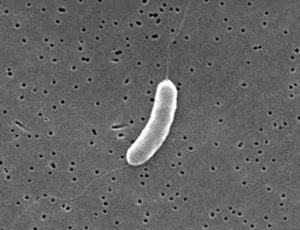 Страшные и опасные болезни человека вызываемые бактериями