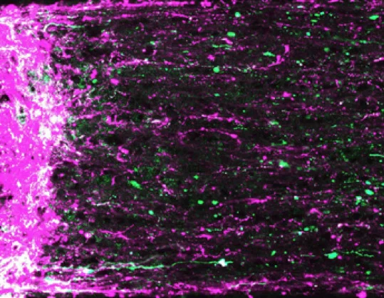 Новый способ доставки лекарств для лечения глазных болезней