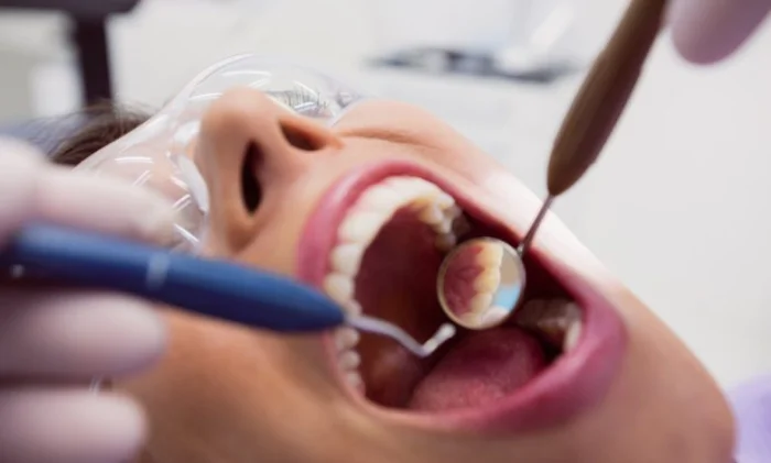 Ученые обнаружили связь между здоровьем десен и повреждением белого вещества мозга