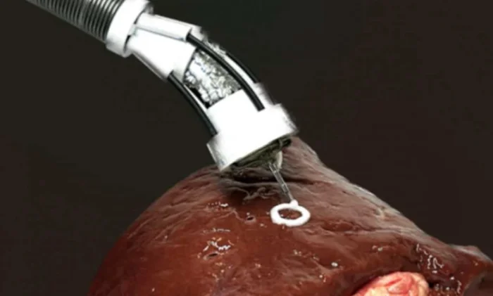 Биопечать прямо в теле: новый гибкий робот