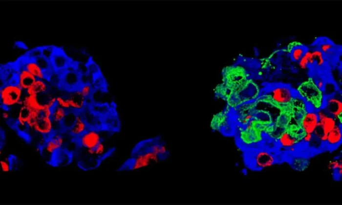 «Супер-трансплантаты», которые могут лечить диабет