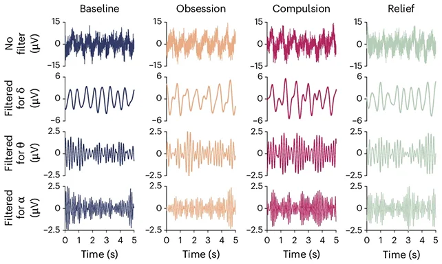 Ученые обнаружили четкий биомаркер обсессивно-компульсивного расстройства в мозге