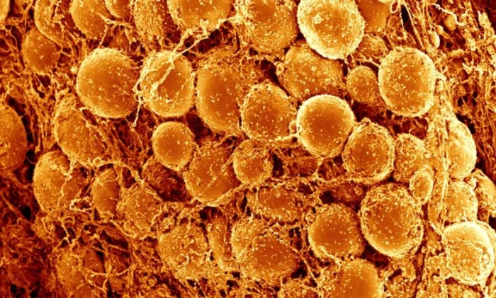 Как бурый жир защищает от диабета и болезней сердца