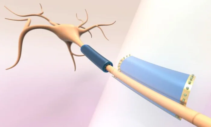 Рассеянный склероз: микроскопические пластинки для восстановления аксонов и уменьшения симптомов