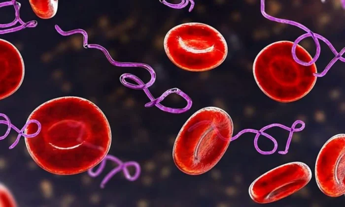 Выявлено вероятное происхождение стойких симптомов болезни Лайма