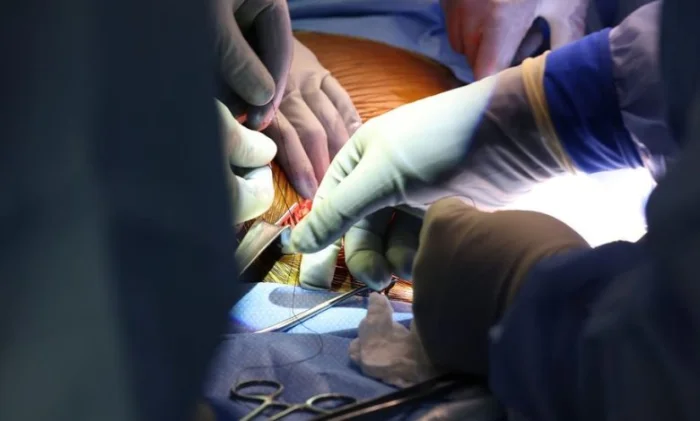 Свиную почку впервые пересадили пациенту-человеку