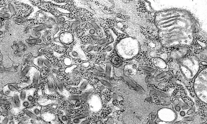 Случай передачи бешенства через пересаженную почку в США выявил пробелы в системе донорства