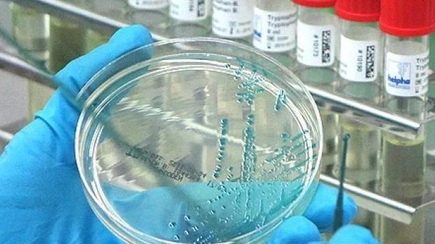 Птичий грипп в США: первый летальный случай зарегистрирован в Луизиане