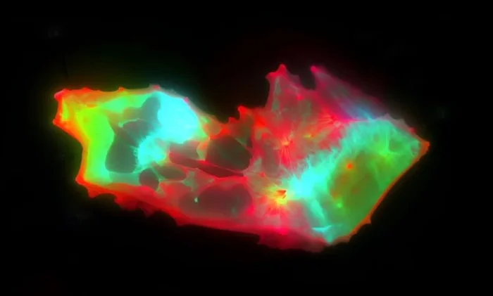 В крови пациентов с длительным COVID обнаружены аномальные микроструктуры