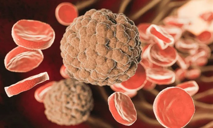 Снижение холестерина может уменьшить риск деменции, показало масштабное исследование