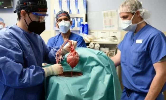 Умер пациент, которому впервые пересадили сердце свиньи