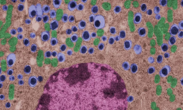 Новая надежда для лечения диабета 1 типа